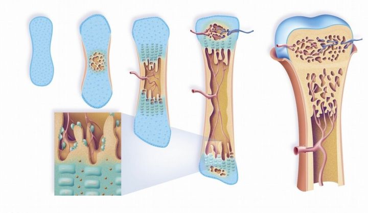 吃米醋的好处和坏处（详解常吃米醋的优缺点）