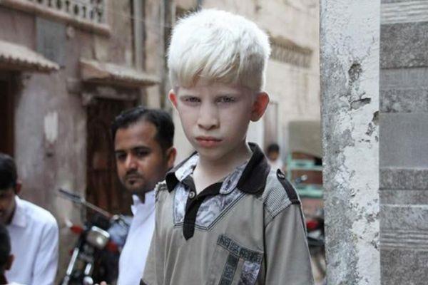 白头发与寿命长短有关系吗 白头发影响寿命吗 白头发与寿命长短有关系吗 白头发影响寿命吗