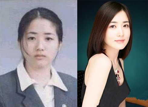 崔贞媛整容过吗?崔贞媛整容前后照片对比曝光