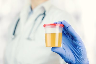 ​尿道炎药物有什么（治疗尿道炎的药物有哪些呢？常见的有3种，需谨遵医嘱）